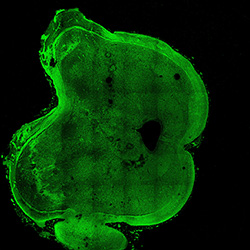 15PCW human midbrain